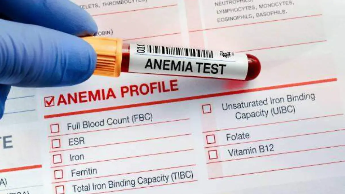 ANEMIA