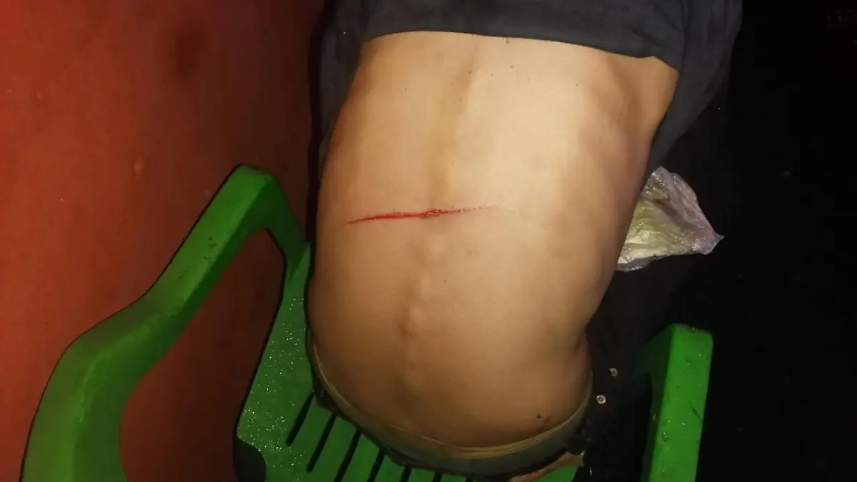 Macheteado