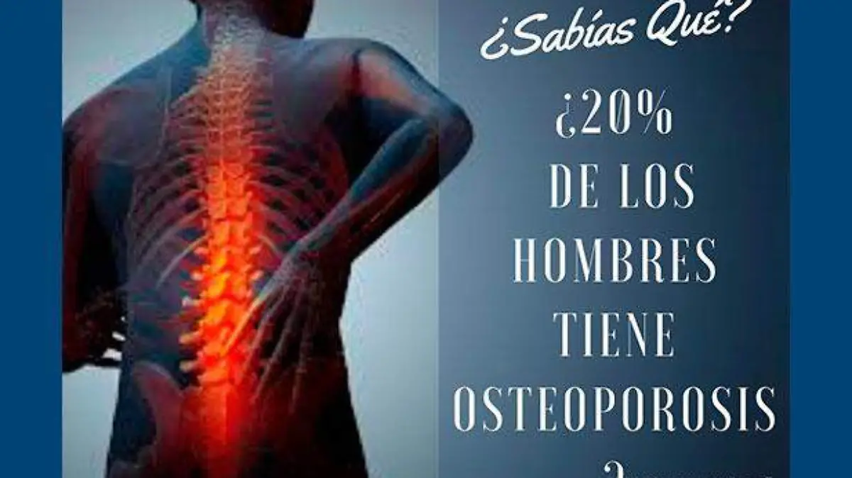 20-por-ciento-hombres-osteoporosis