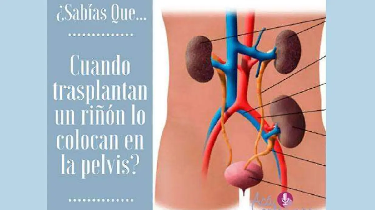 Trasplante-riñón