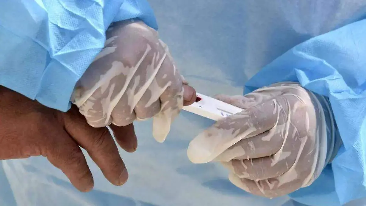 coronavirus-pruebas-AFP