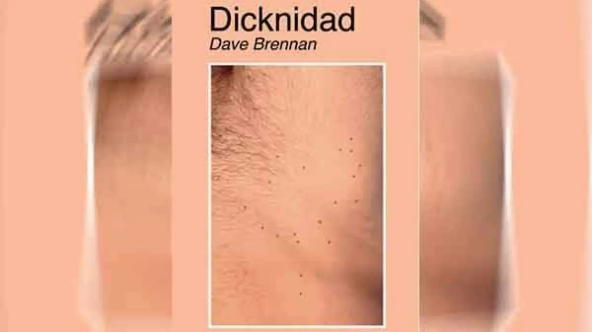 Dicknidad