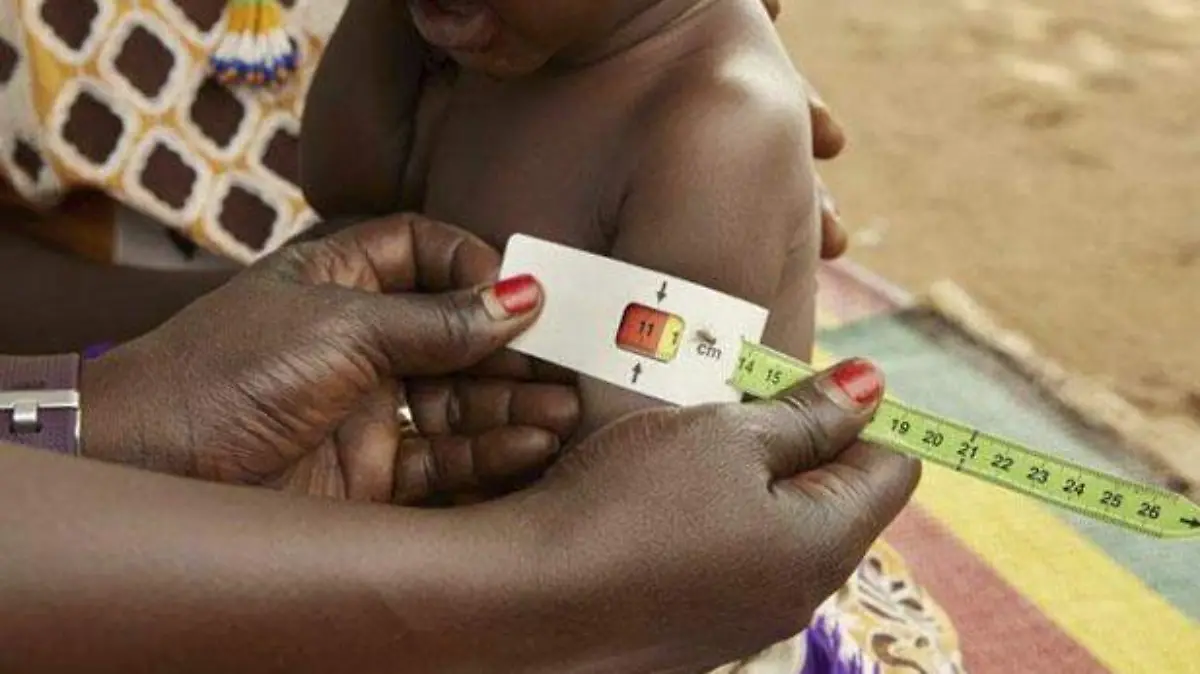 Desnutrición Sudán-UNICEF