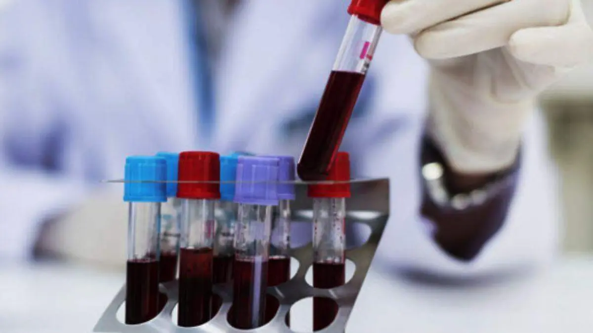cientifico-analizando-muestras-de-sangre