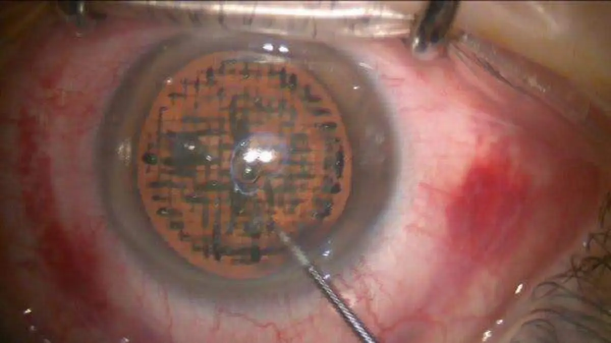 Ojo 3