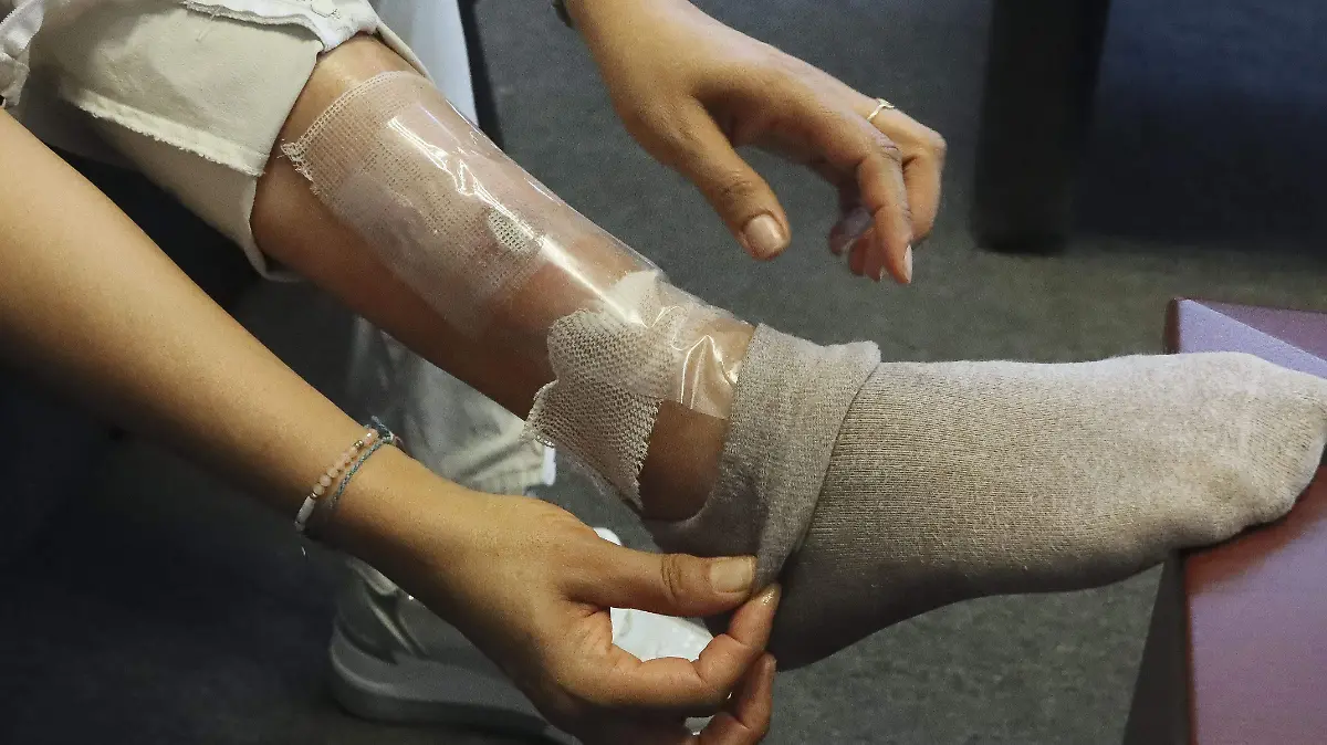 240509_QUEMADURA_ENTREVISTA_MC_7