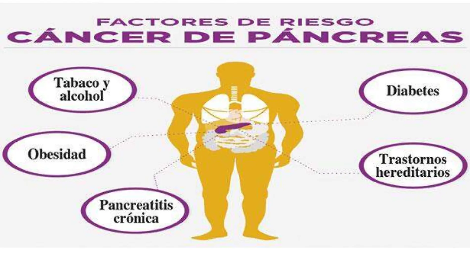 pancreas