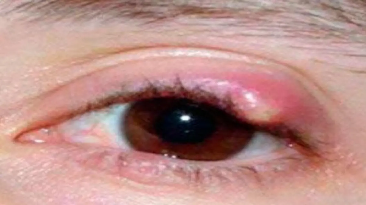ojo