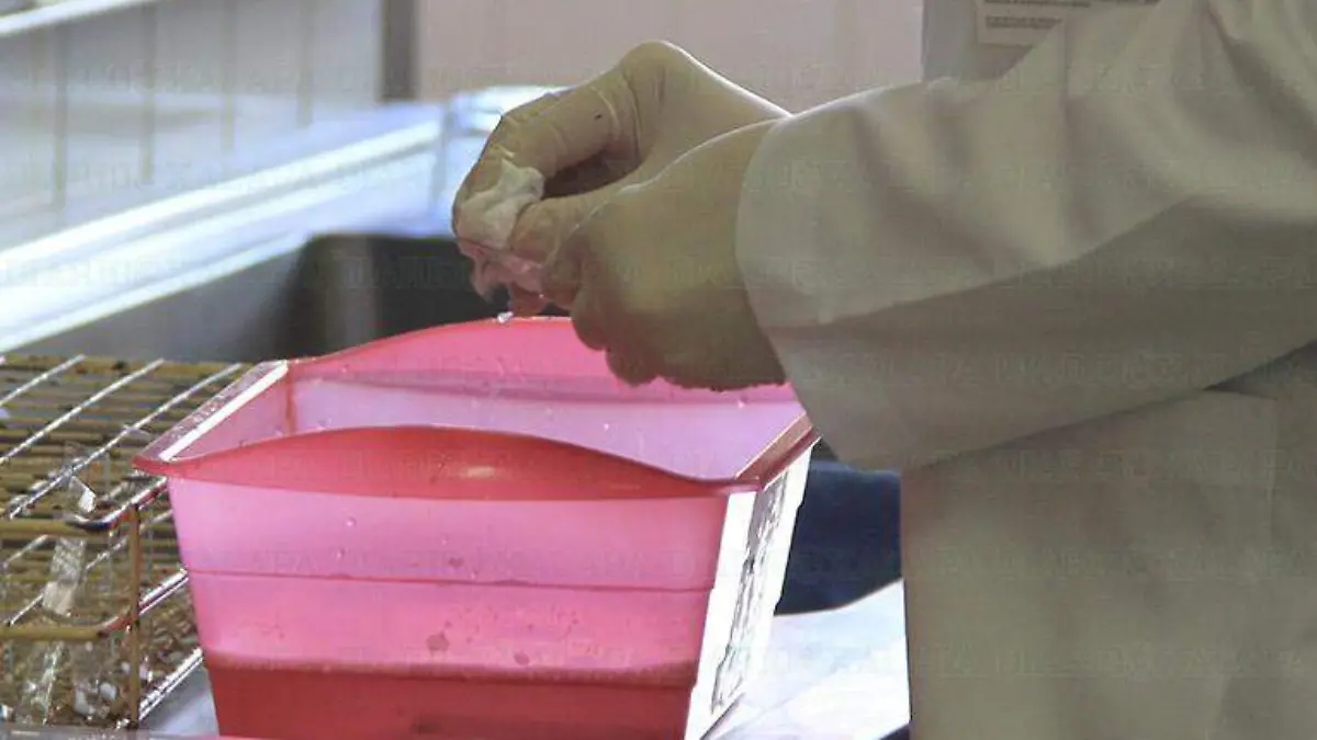 Analisis para diabetes