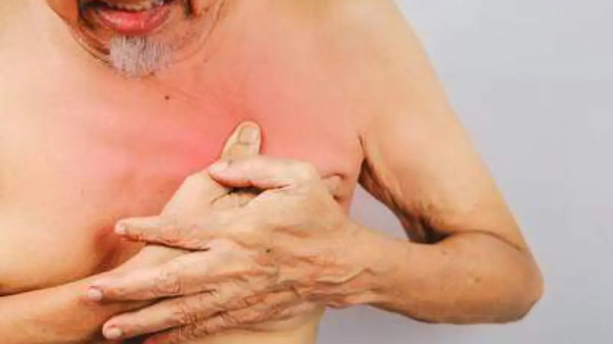 cancerdemamaenhombres