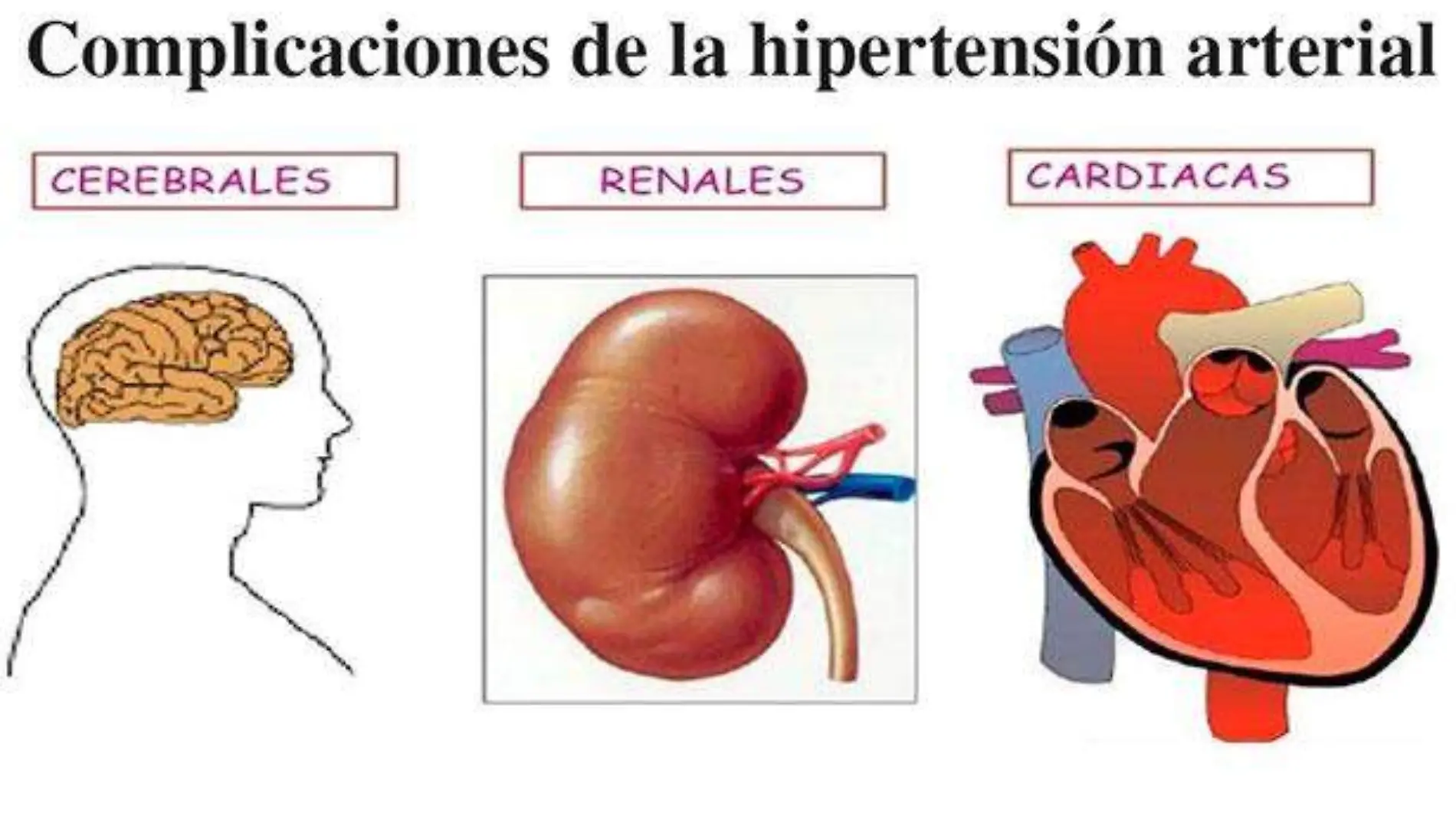 enfermedades