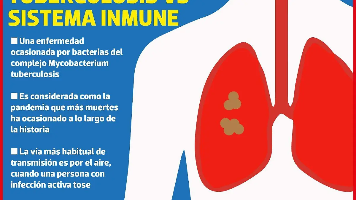 Tuberculosis