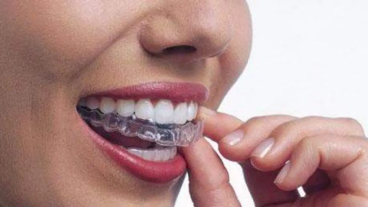 Dientes