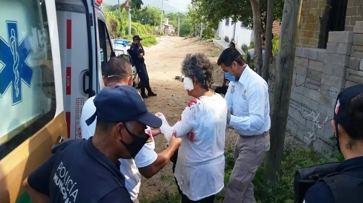 agresión