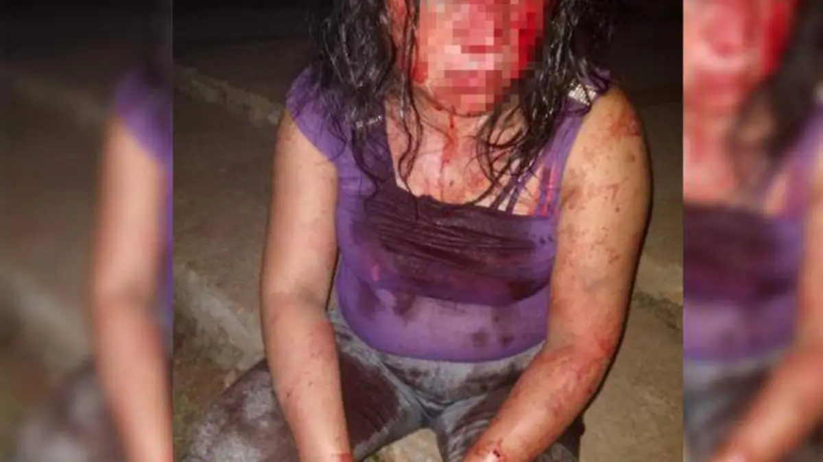 Mujer Golpeada