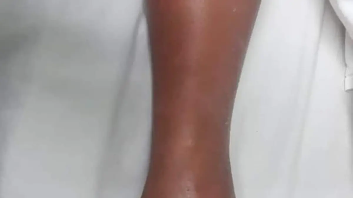 Ataque de serpiente mujeres Ocosingo2