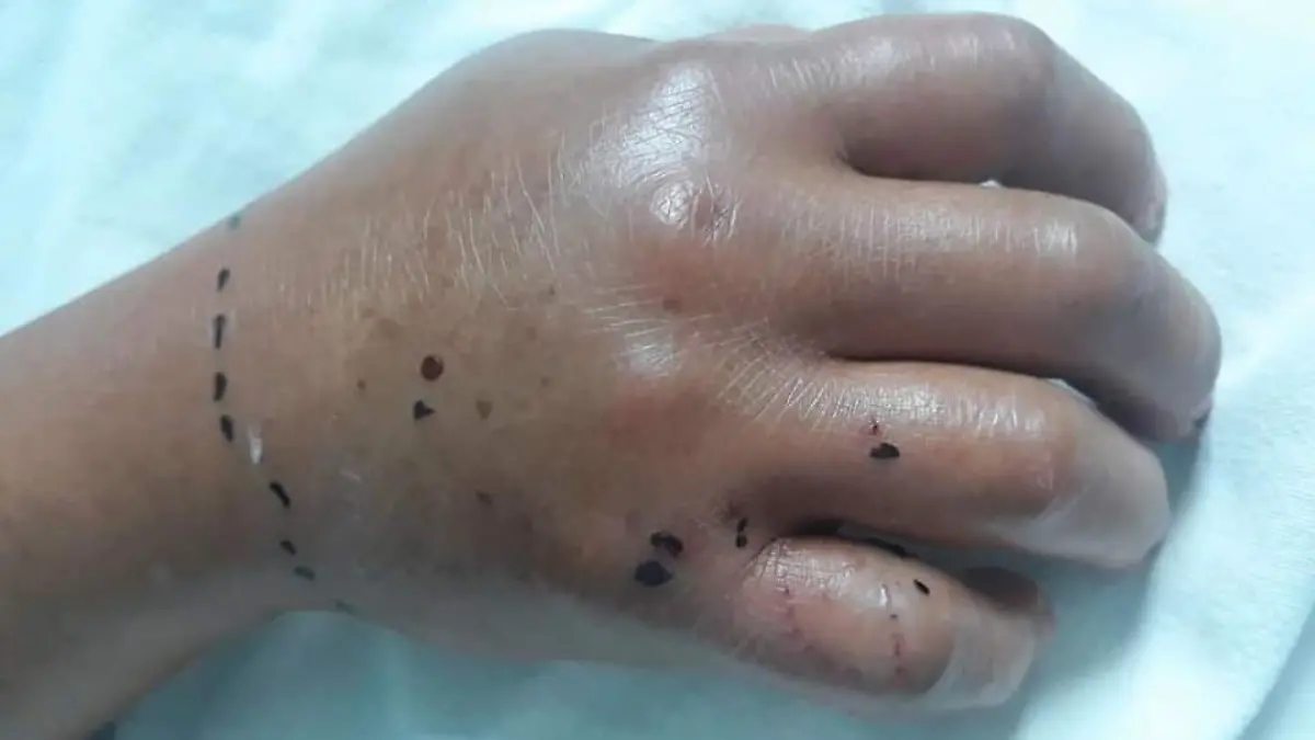 Ataque de serpiente mujeres Ocosingo