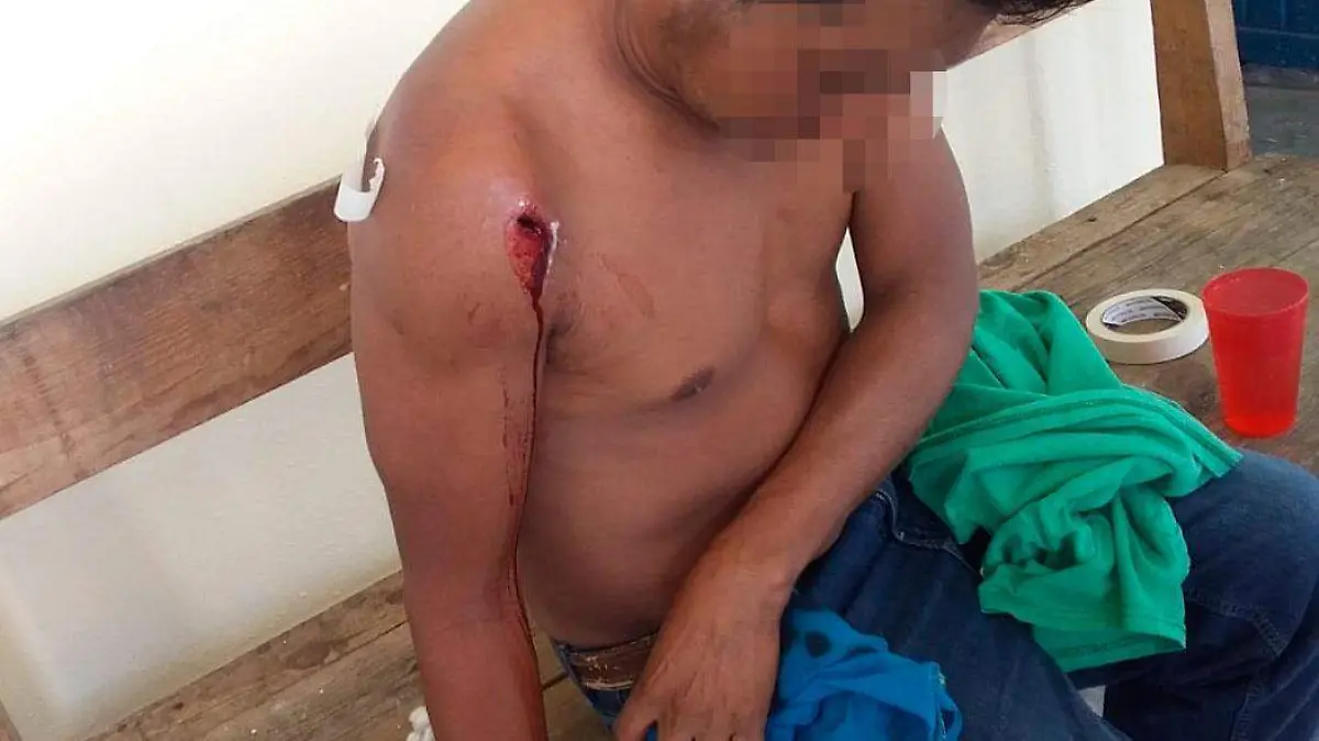 herido-chenalhó
