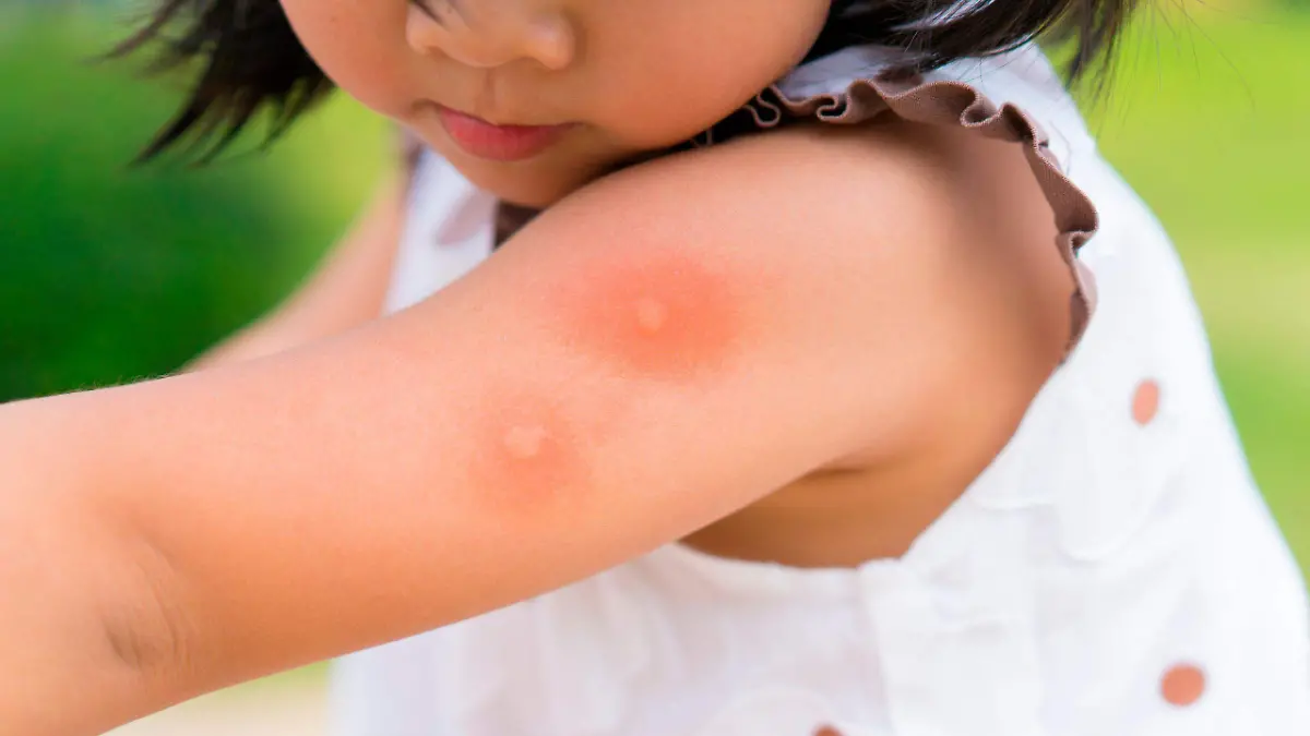 Afterbite_Blog_Junio-scaled