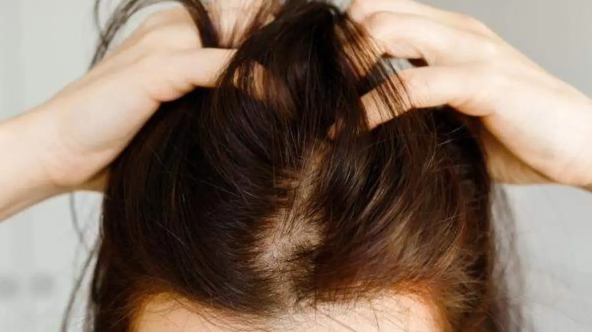 cabello