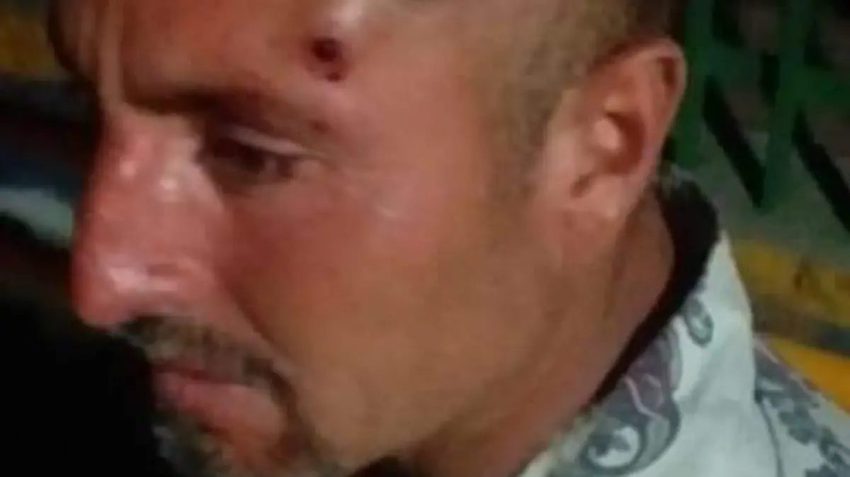 Barzonista herido-CORTESÍA ARMANDO VILLA