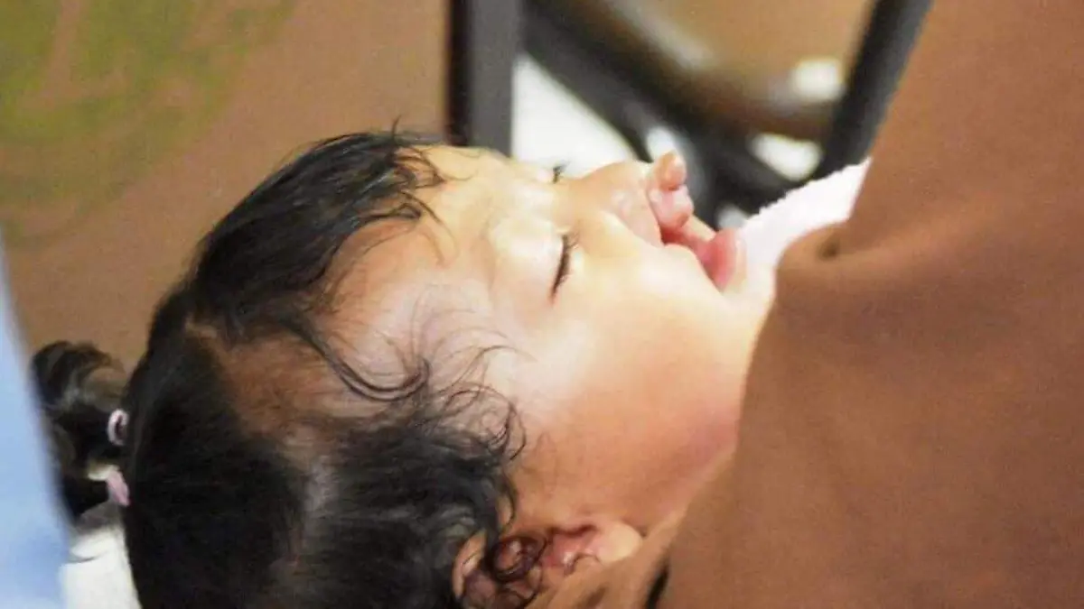 1 Operarán a 48 personas en campaña de labio y paladar hendido