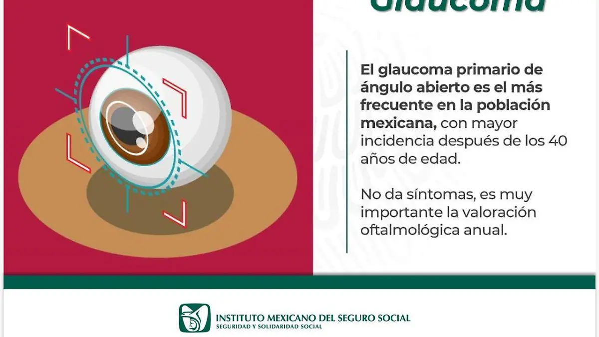 glaucoma