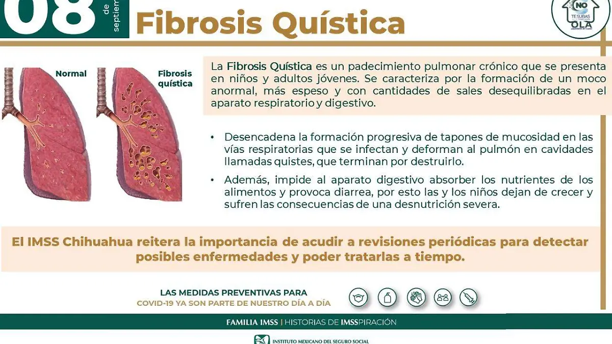 fibrosisquisica