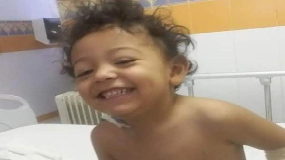 Ángel Alexandro Castañeda de 2 añitos, SUFRIO QUEMADURAS GRAVES AL CAER A ESTIERCOL YA OPERADO