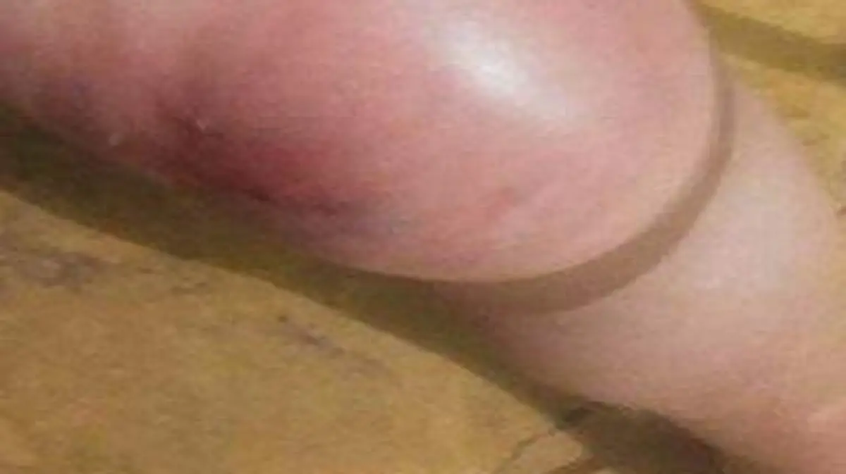 rodilla lastimada de la sra de la 3ra edad por la monja