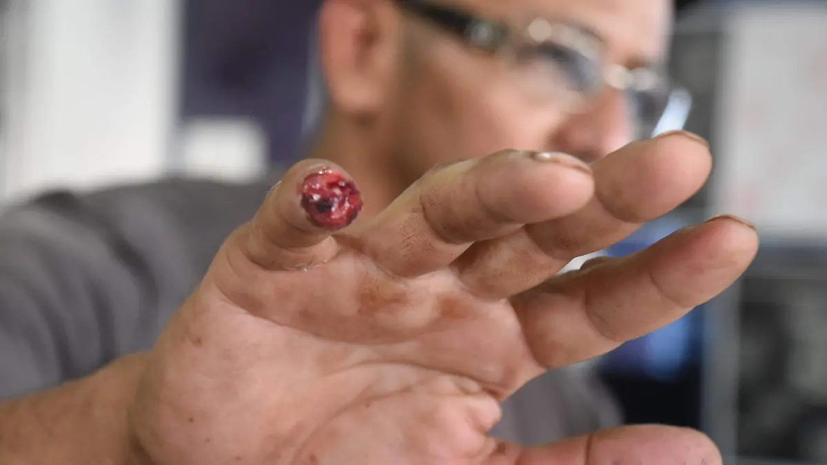 golpeado por ministerial (6)