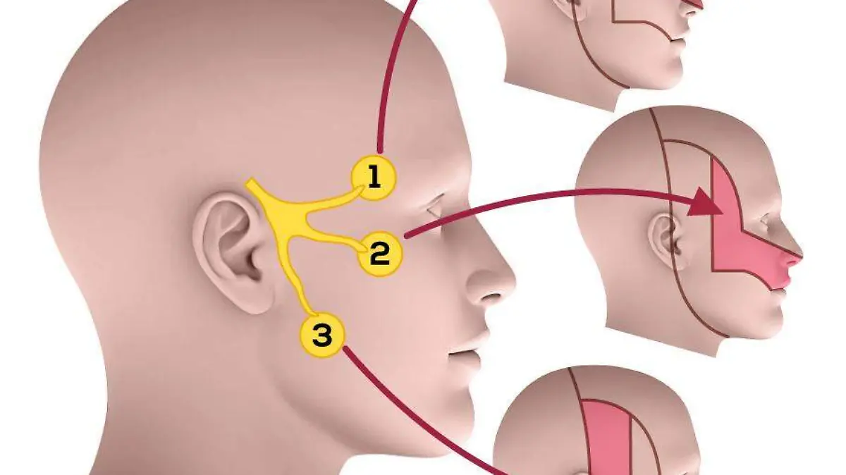 Neuralgia cts gobierno de méxico