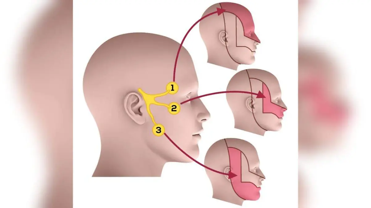 Neuralgia