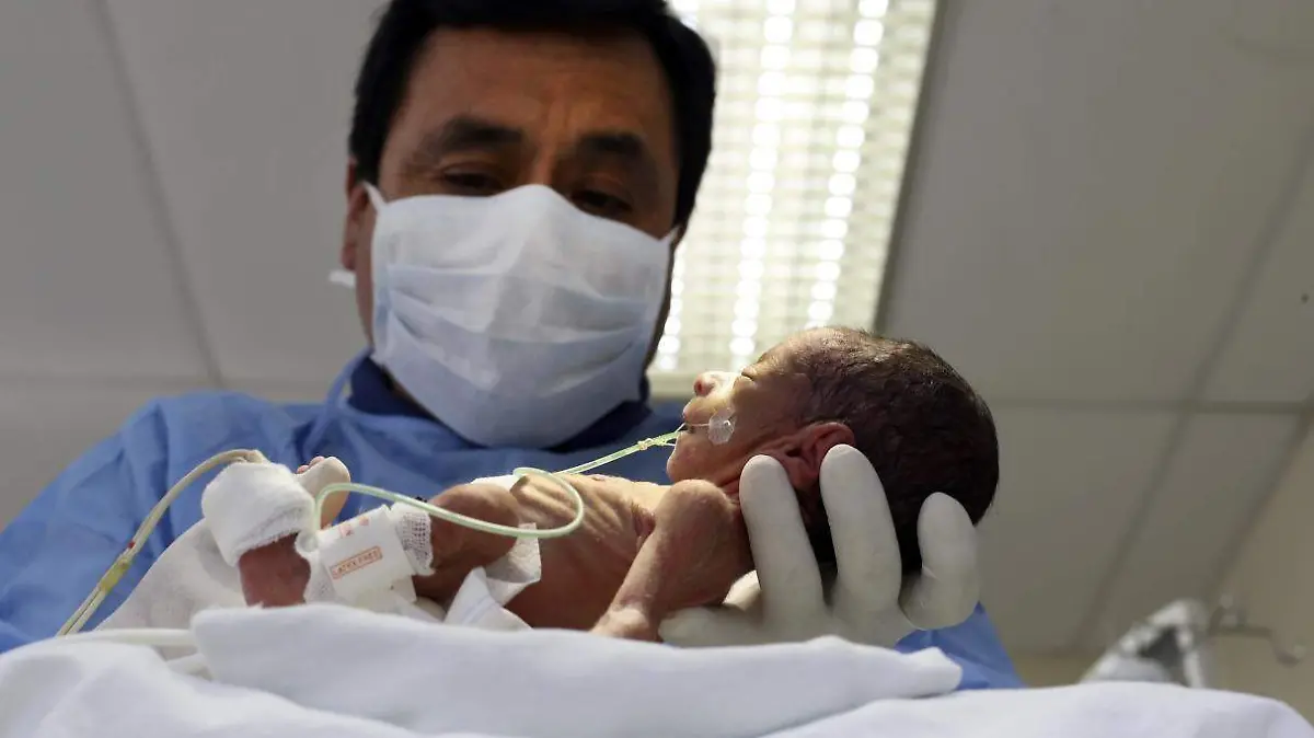 BEBES PREMATUROS  (1)