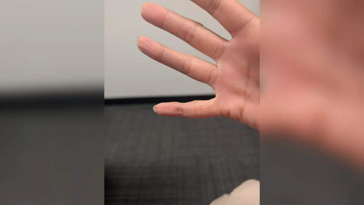 Smartphone pinky