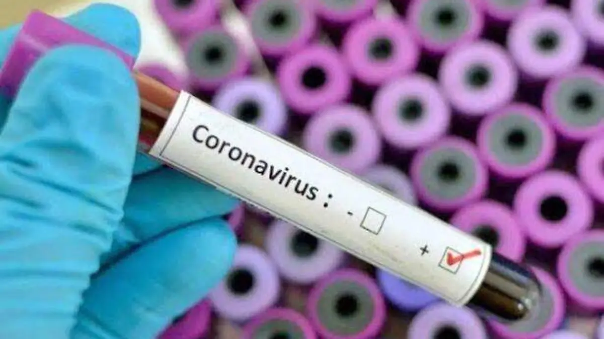 virus
