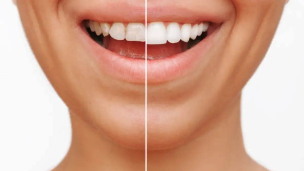 El producto que puede poner en jaque tu salud bucal