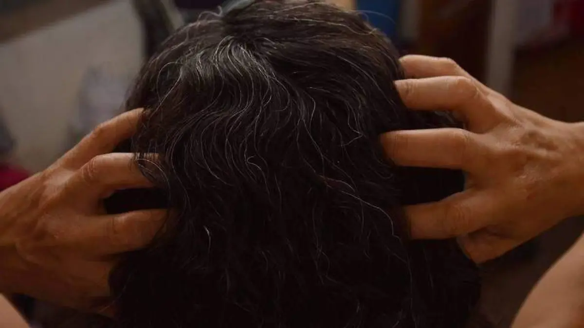 Mujer rascándose la cabeza