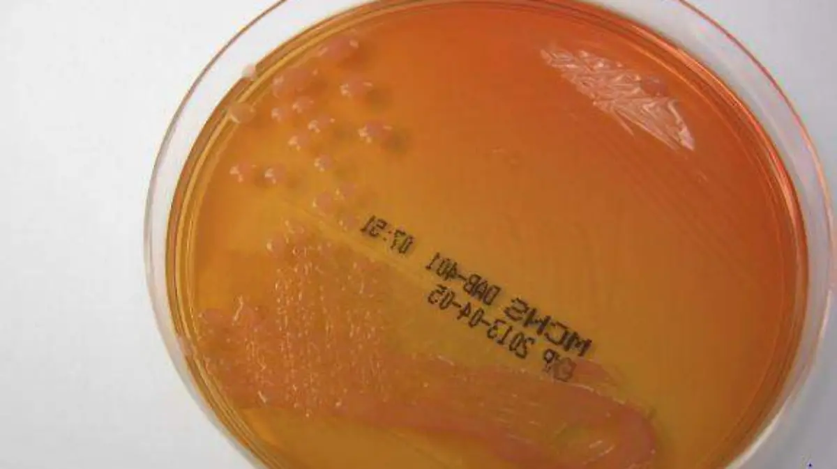 bacteria