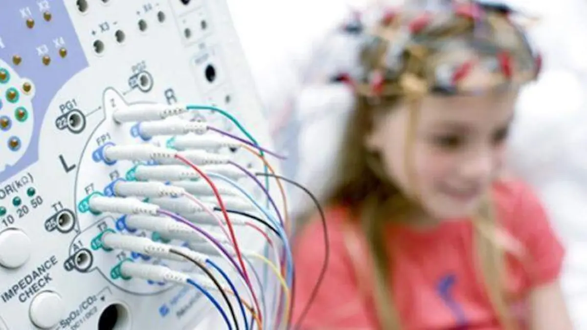 epilepsia-infantil-2