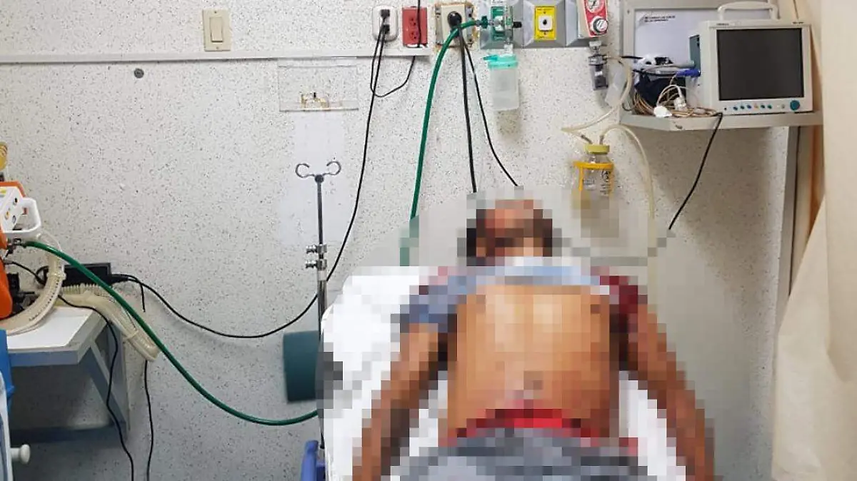 asesinado taxco