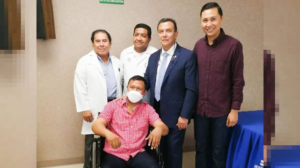 transplante en el quemado