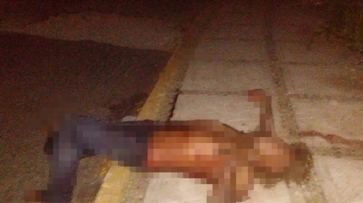 Acapulco - herido en la av cuauhtémoc