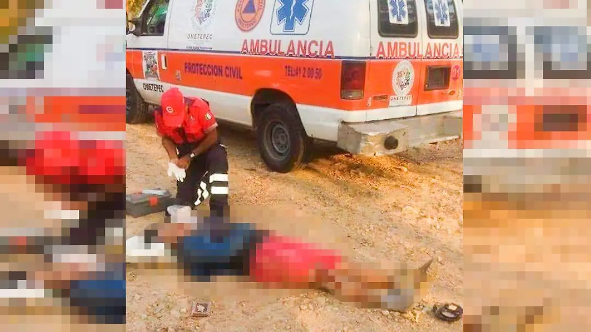 lesionado igualapa