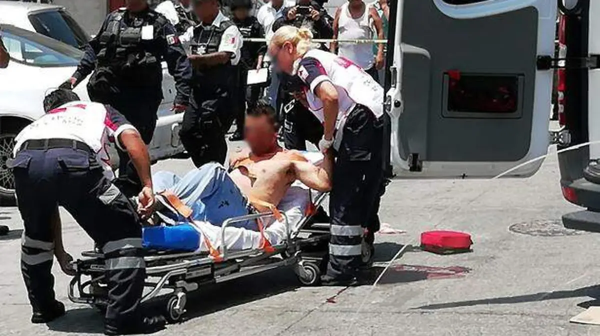 Herido por arma de fuego en la progreso