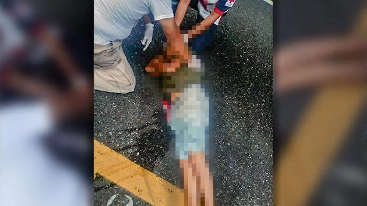 Acapulco - mujer atropellada en la escéncia