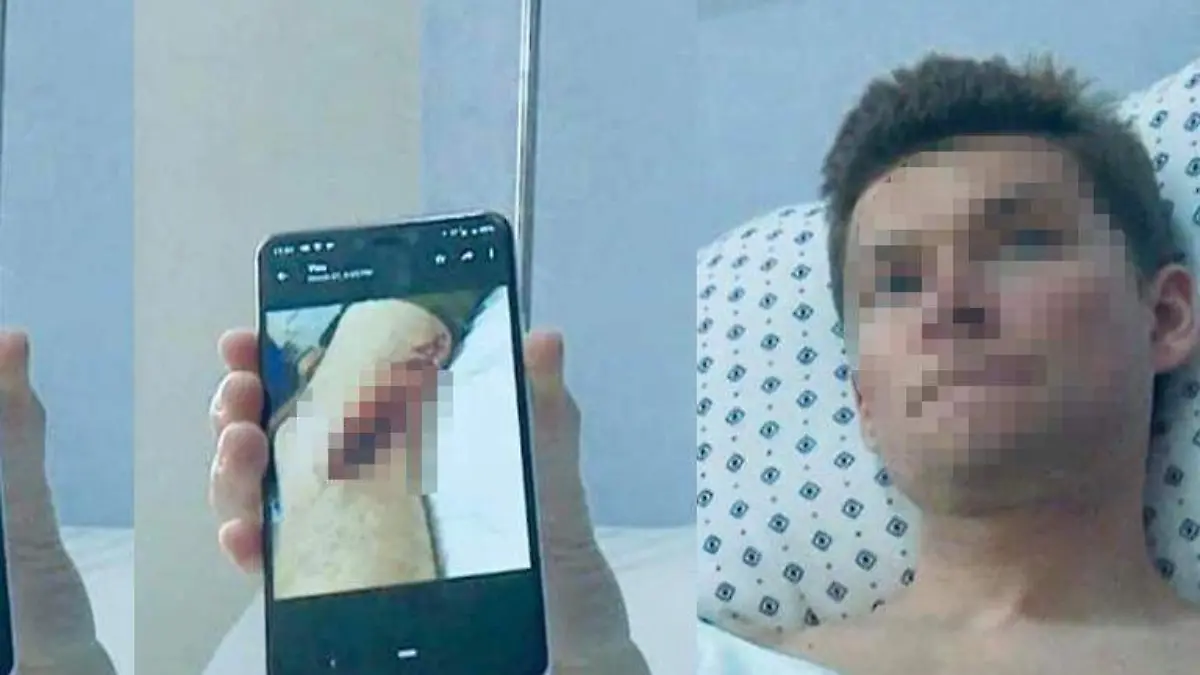 ACapulco ataque tiburón