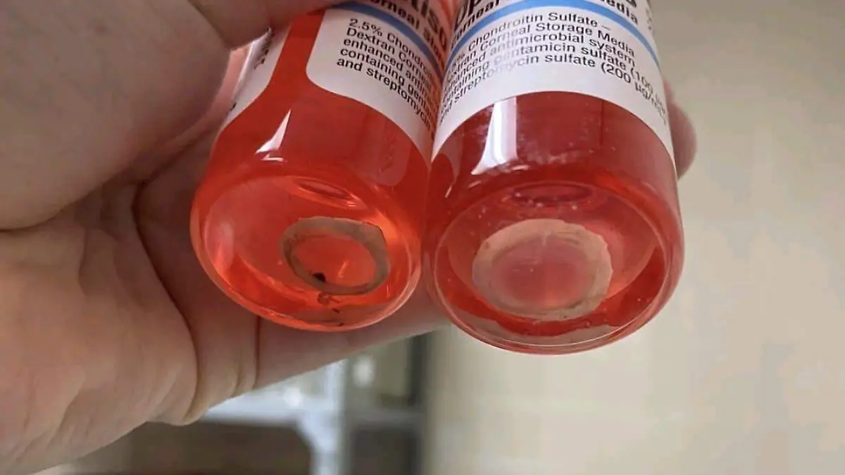 corneas