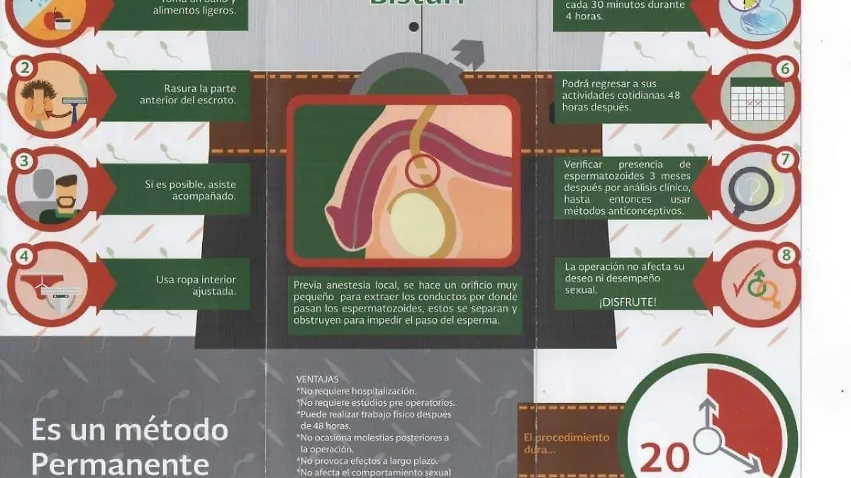 Vasectomía