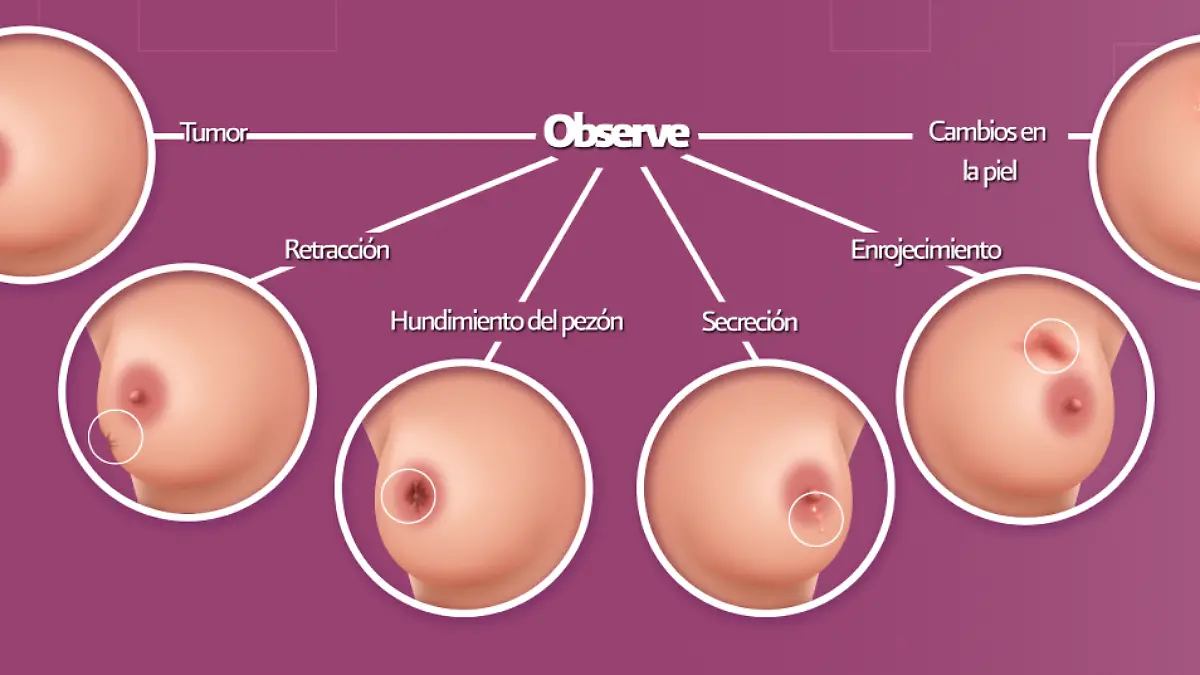 autoexplora-Observe-Gob-México